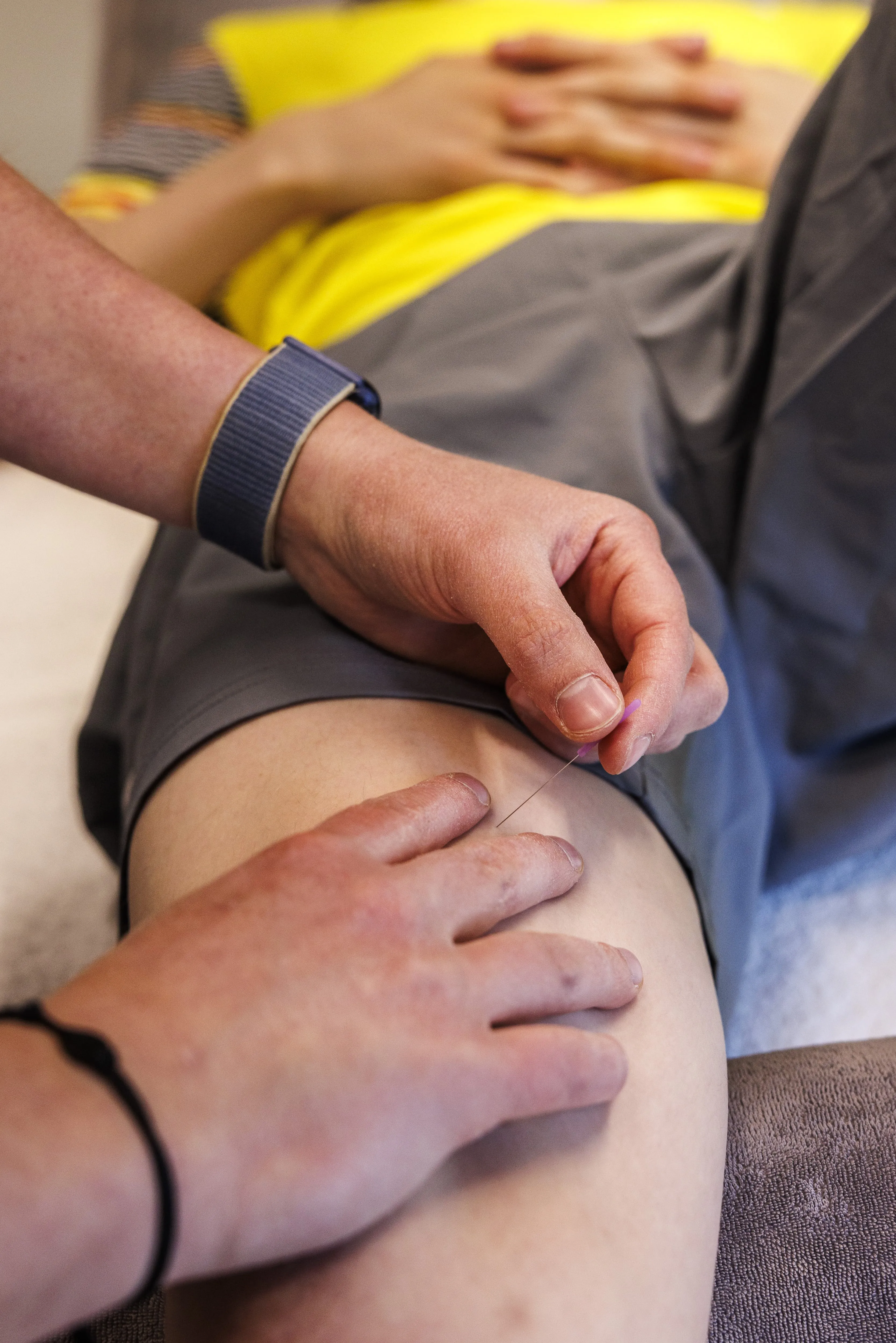 Dry Needling Behandeling
